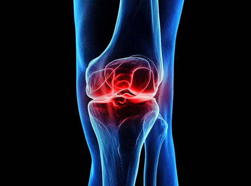 Orthopedic infection issues